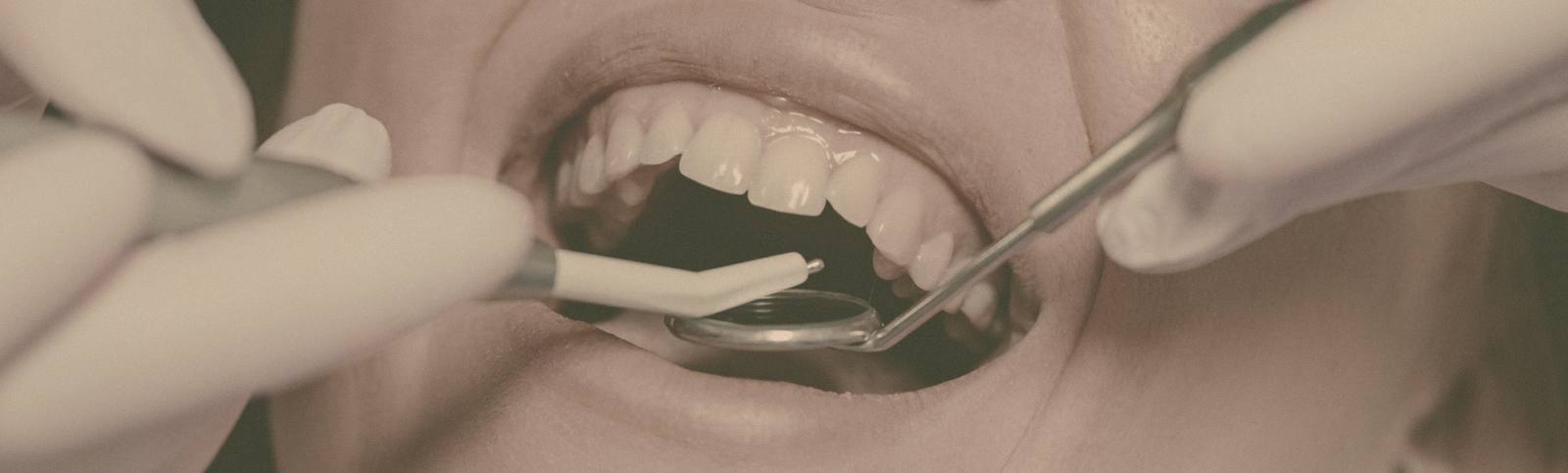 How To Treat Gum Infections